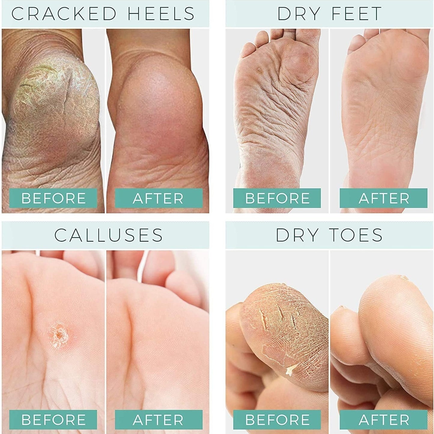 INTENSIVE FOOT REPAIR SALVE